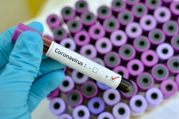Coronavirus Calabria, il bollettino della Regione del 6 maggio