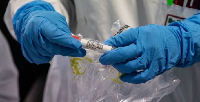 Coronavirus Calabria, contagi in calo ma ci sono otto morti